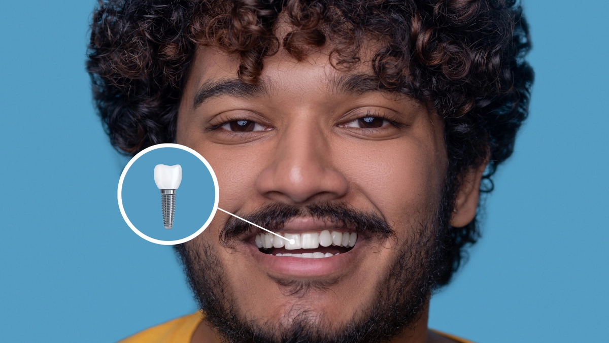 Cosmetic Dental Implant