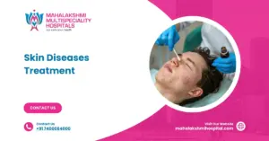 Skin Diseases Treatment