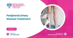 Peripheral Artery Disease Treatment