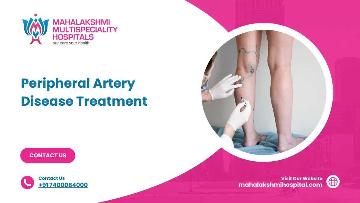 Peripheral Artery Disease Treatment